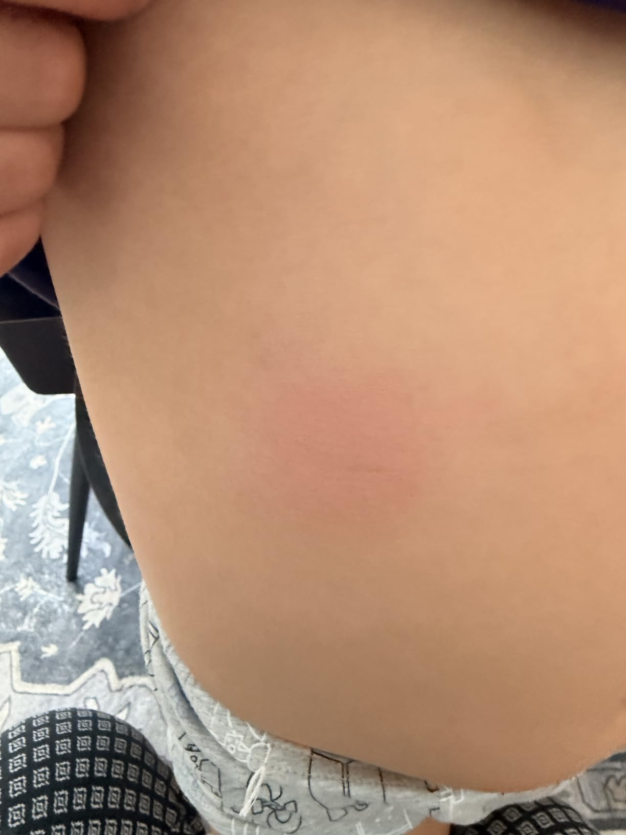 Kleines Fläschchen, großer Effekt